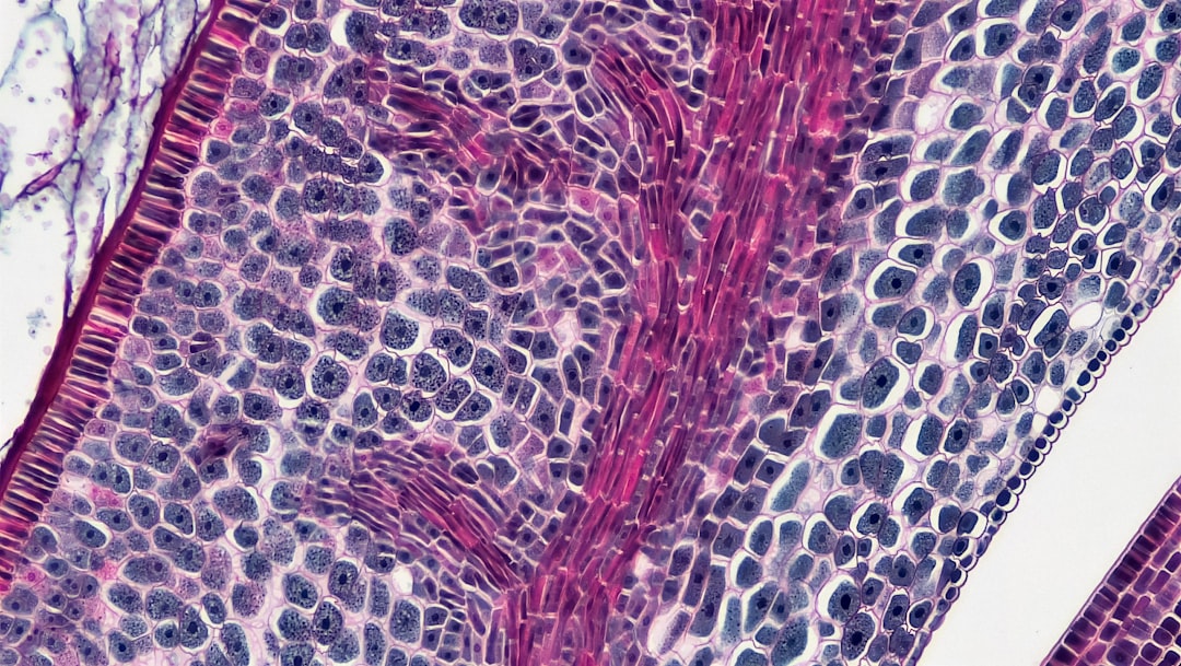 Photo celiac disease