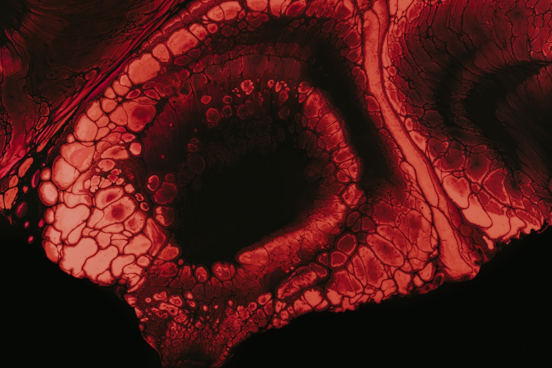 Photo hipocalcemia